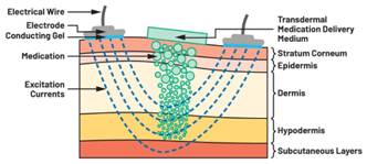  圖5.人體皮膚分層橫截面以及TMD和生物阻抗測量  考慮到生物阻抗分析的無創性，使用兩個金屬電極代表電氣傳感器，連接模擬前端(AFE)電路和患者皮膚。這個金屬與非金屬的接觸點是構成整個電路的另一個關鍵部分，連接了AFE和人體電氣模型。電荷載體（電極中的電子和人體內的離子）之間的相互作用可能對這些傳感器的性能產生重大影響，需要根據每種應用進行具體考慮。首先，金屬與離子溶液接觸的相互作用導致金屬表面附近溶液中離子濃度的局部變化。這種現象會改變電極下方區域的電荷中性，導致金屬周圍的電解質電位與溶液其余部分不同，從而在金屬和電解質主體之間產生一個電位差，即常說的“半電池電位”。其次，注入電流的直流分量會導致電極極化。  表1.各種電極類型和相應的半電池電位  金屬及反應  半電池電位(V)  Al → Al3+ + 3e- Al → Al3+ + 3e-  –1.706 –1.706  Ni → Ni2+ + 2e- Ni → Ni2+ + 2e-  –0.230 -0.230  H2 → 2H+ + 2e- H2 → 2H+ + 2e-  0.000 (by definition) 0.000（根據定義）  Ag + Cl- → AgCl + e- Ag + Cl- → AgCl + e-  +0.223 +0.223  Ag → Ag+ + e- Ag → Ag+ + e-  +0.799 +0.799  Au → Au+ + e- Au → Au+ + e-  +1.680 +1.680  這是一種不良現象，往往導致電極性能下降。這些考量表明，電極也需要定義適當的電氣模型（參見圖6）。我們可以將干電極表示為具有三個串聯元件的電路：一個用于模擬半電池電位(EHC)的直流電源；一個用于模擬金屬和非金屬（人體）之間接觸的RC并聯電池(Rd||Cd)；以及一個用于模擬電極金屬的電阻Rs。